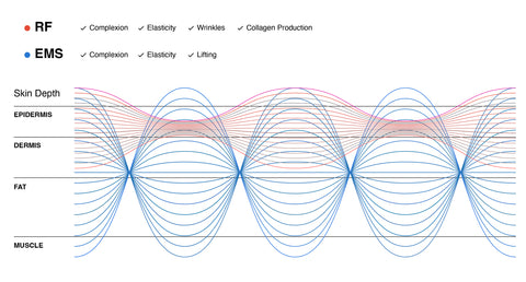 How Radiofrequency Technology Actually Works to Combat Aging