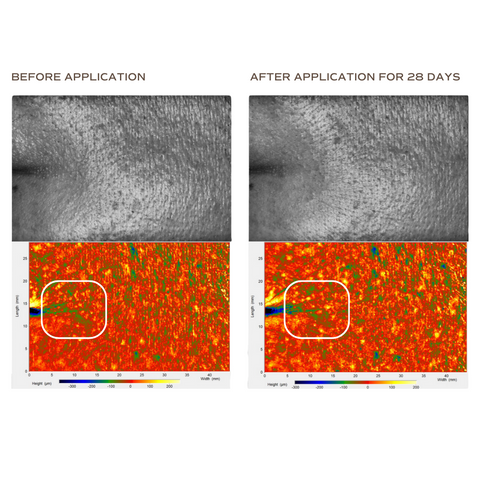 49.16%* decrease in wrinkle area around eyes
