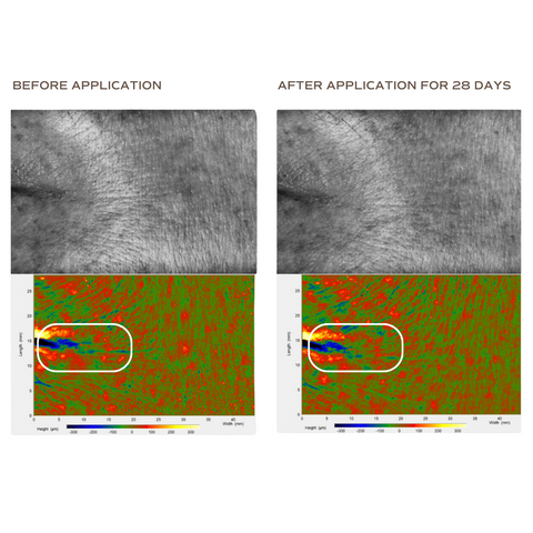 47.62%* decrease in wrinkle count around eyes
